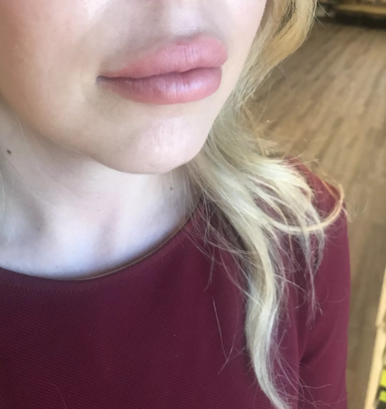 $600 for Lip Fillers in Plano Is Exactly What Our Faces Need